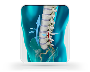 Spinal Decompression
Back Pain Therapy