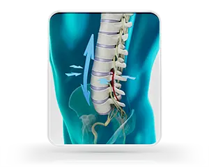 Spinal Decompression
Back Pain Therapy