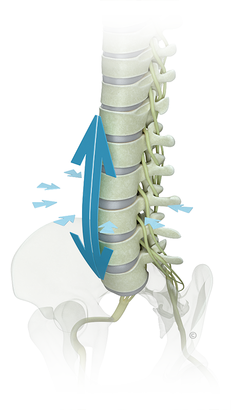 Spinal Decom